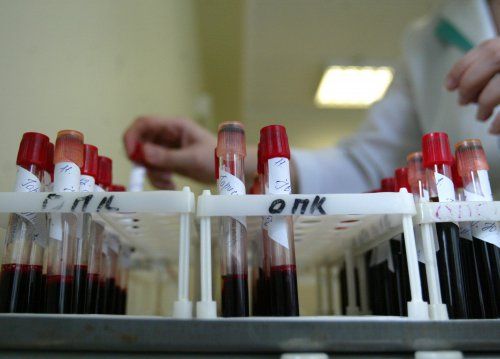 Аналіз крові на гемоглобін і кількість еритроцитів - одне з найважливіших обстежень