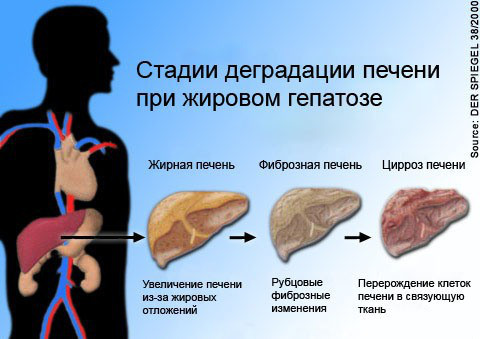 Чи варто знижувати рівень холестерину такою ціною