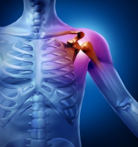 Ендопротезування плечового суглоба - операція, при якій відтворюються змінені після травм або захворювань суглобові поверхні лопатки і плечової кістки за допомогою штучних імплантів