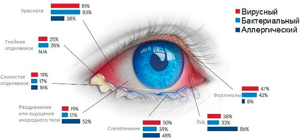 Гній в очах утворюється через запалення кон'юнктиви, і розвивається при цьому захворювання називається алергічним кон'юнктивітом