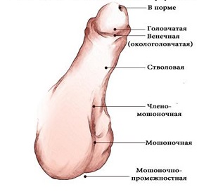 Щоб зрозуміти, як відкривається головка у хлопчиків, потрібно вникнути в будову статевого органу