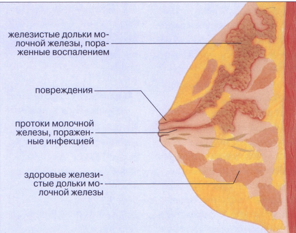 (клікабельно)