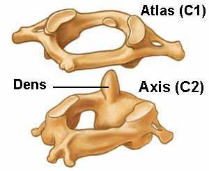 Атлант не має тіла хребця, а складається з передньої і задньої дужок