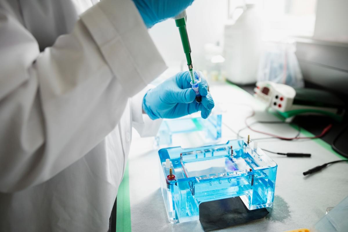 Попередімплантаційна генетичне тестування (СМТ) - це лабораторний аналіз ДНК ембріонів, який проводять з метою виявити ембріони з генетичними патологіями перед штучним заплідненням