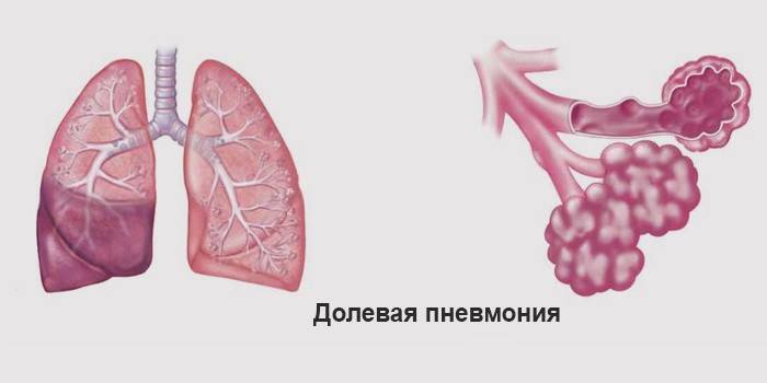 часткова