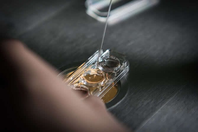 Внутрішньоматкова інсемінація (ВМІ) -   один з методів   лікування безпліддя