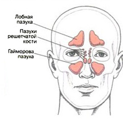 Нежить - це локальна простуда, при якій слизисті оболонки носа запалюються, розвивається набряк