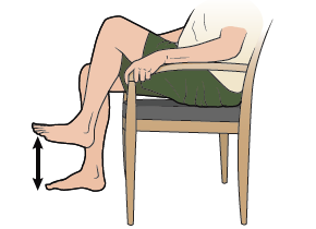 Ця інформація розповідає про те, як знизити ризик розвитку лімфедеми ніг