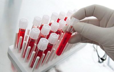 Багато видів гельмінтів маскують свою присутність симптомами, прийнятими людиною за звичайну втому або авітаміноз