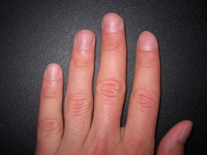 Деякі люди часом задаються питанням, чому нігті на руках ребристі, горбисті і що з цим робити