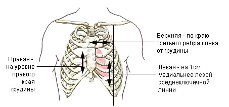 Верхню межу визначають шляхом пересування пальців зверху вниз по міжреберних проміжків зліва від грудини і відзначають по третьому межреберью зліва від грудини