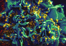 Вірус ВІЛ-інфекції, Фото: NIAID via Foter, CC BY 2