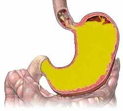 Одна з найчастіших причин