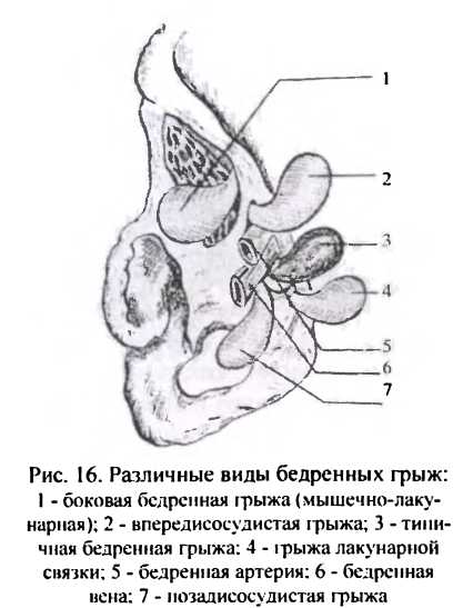 16)