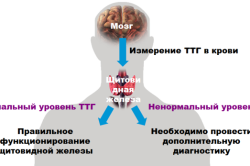 За процесом виробництва щитовидкою гормонів стежать дві ендокринні залози: гіпоталамус (розташовується в головному мозку і пов'язує в єдині узи ендокринну і нервову системи) і гіпофіз (знаходиться в турецькому сідлі в області мозку)