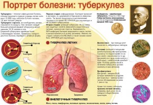 Особливо складно діагностувати туберкульоз у дітей