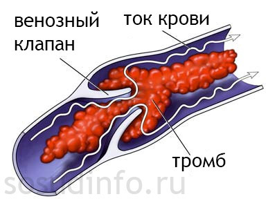 Автор: М