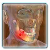 Якщо не почати своєчасне лікування, недуга може привести до випадання здорових зубів