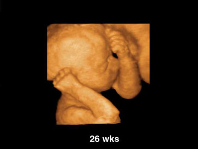 Плід 26 тижнів 3D УЗД