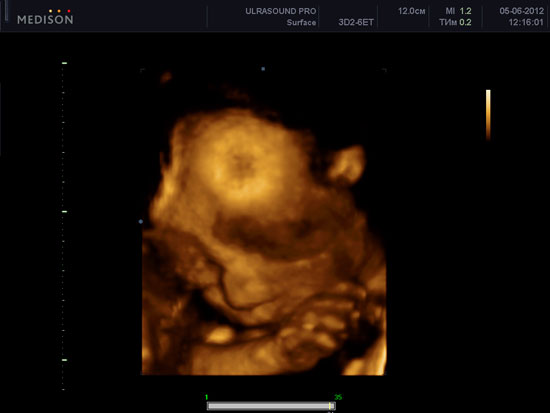 Вартість узі при вагітності в 3 триместрі (з 27 по 40 тиждень) становить 650 гривень