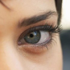 Ячмінь на оці - дуже неприємний недуга, який вимагає термінового лікування, оскільки являє собою гнійне заповнення, що знаходиться поблизу цибулини очі
