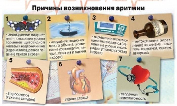 спеціальна дієта;   народні способи;   лікарські препарати (таблетки, ін'єкції);   дихальна гімнастика;   точковий масаж;   гомеопатія;   хірургічне втручання (припікання тканин серця)