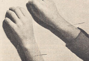 Лікар вибирає потрібні ліки, змінює їх в певній послідовності, призначає в різних поєднаннях, визначає дозу в залежності від характеру захворювання, особливостей його перебігу у даного пацієнта в даний час