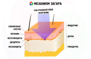 Зовнішні фактори, що призводять до появи лущення родимки