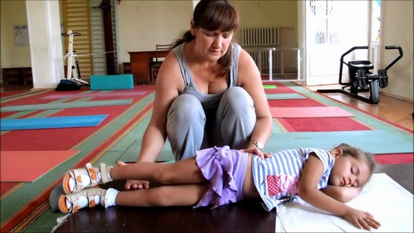 раптовість рухів;   повільність і червоподібного;   надлишкова динаміка;   безцільність;   некеровані рухові рефлекси