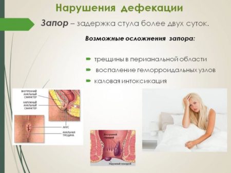 Інтоксикація при запорах