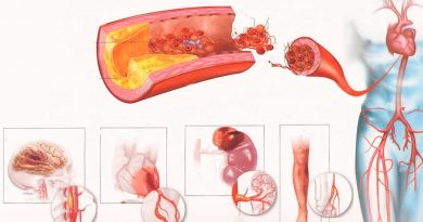 Вам також може сподобатися