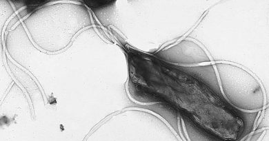 Лікування атеросклерозу прополісом