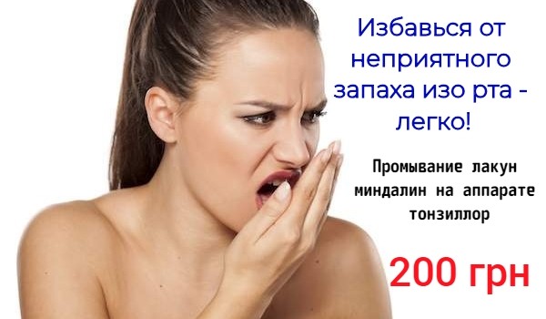 При хронічному або гострому тонзиліті у пацієнтів виникає виражене запалення мигдалин, в лакунах яких накопичується гнійний ексудат