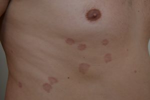 І все це триває протягом доби, а потім процедура повторюється