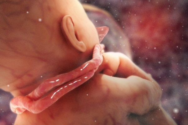 Подвійне обвиття кілька ускладнює пологи природним шляхом, тому акушера потрібно заздалегідь довести до відома, щоб пологи пройшли благополучно