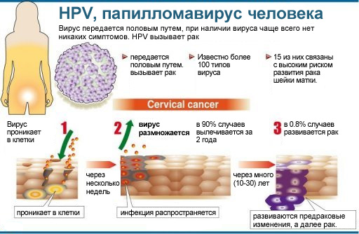 Все це різні прояви вірусу папіломи людини