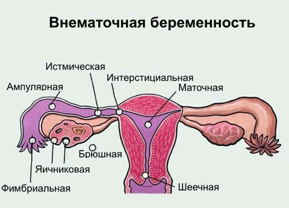 Доктор може призначити банальний аналіз крові