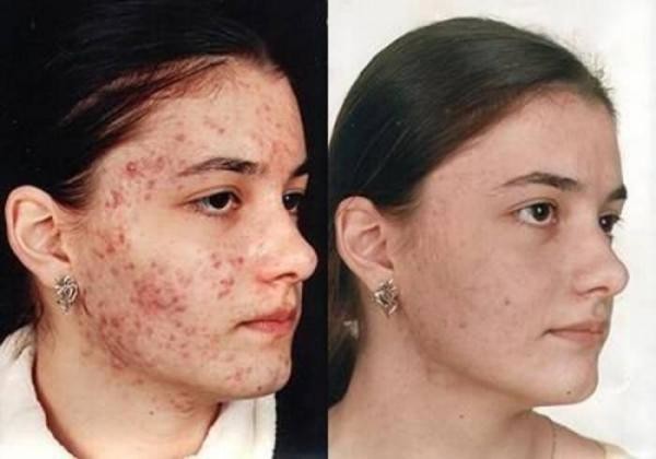 Їх застосування вкрай ефективно