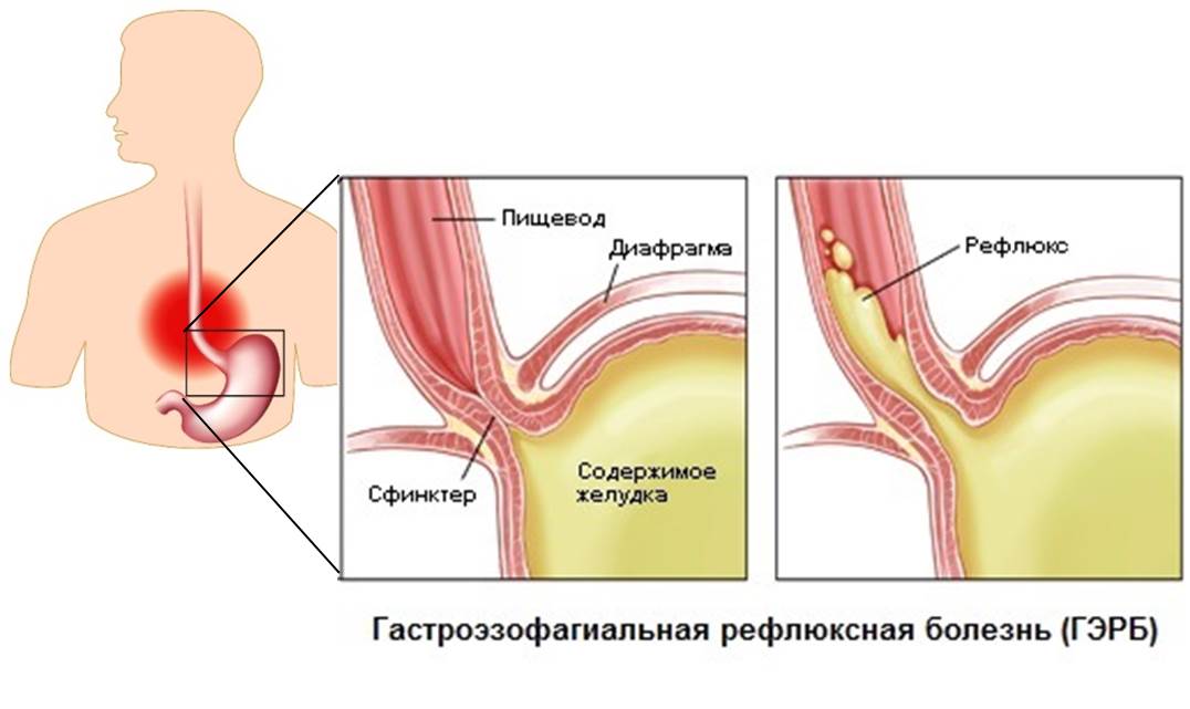 Наш організм влаштований так, що переміщення повинно відбуватися тільки в одному напрямку: їжа зі стравоходу повинна потрапляти в шлунок