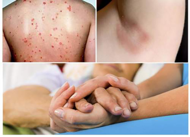 Правильне управління діабет може дозволити людині жити активним, щасливим життям