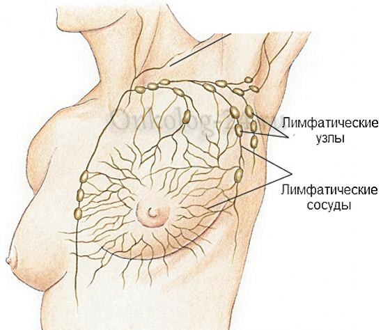Онкологія лімфовузлів під пахвами, що це таке