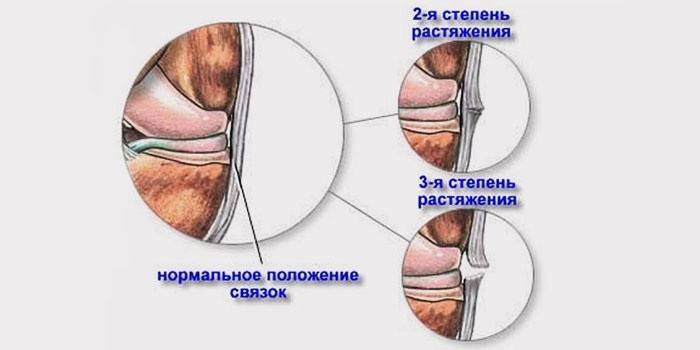 Різкими ривками батьки можуть потягнути зв'язки рук малюків