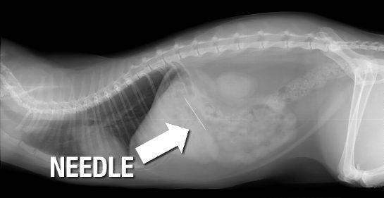 Що буде якщо проковтнути голку