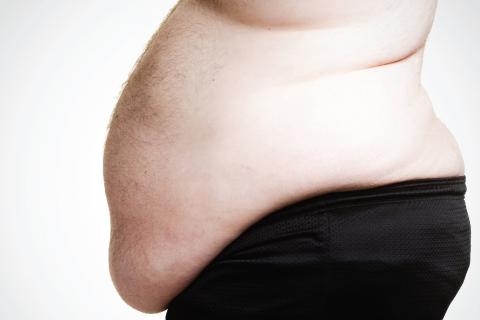 Основні винуватці - зайва вага і ожиріння, низька рухова активність, генетичні фактори і старіння