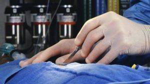 Сьогодні визнається, що лікування варикоцеле можливо тільки шляхом хірургічного втручання