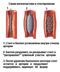 хірургічні маніпуляції