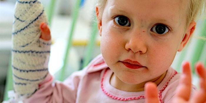 При виявленні ниркової недостатності з кліренсом креатину, певним за допомогою проби Реберга не менш 30 мл / хв, доза Найза не знижується, якщо цей показник нижчий - таблетки вживати категорично забороняється