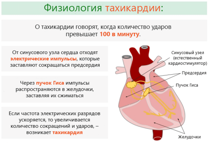 • Фібриляція шлуночків - при ній спостерігаються хаотичні скорочення волокон міокарда, найстрашнішим ускладненням такої тахікардії може бути інфаркт міокарда