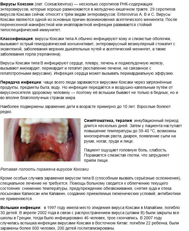 Вірус Коксакі (джерело - Вікіпедія)