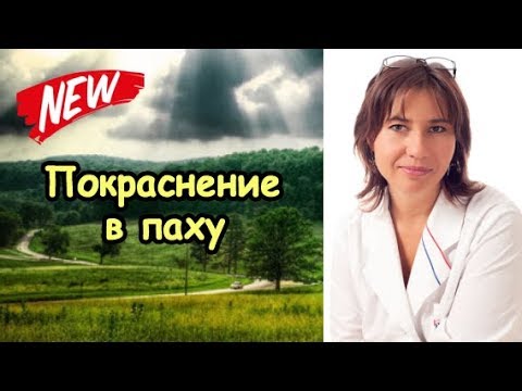 Чому з'являються червоні точки на голівці чоловічого органу